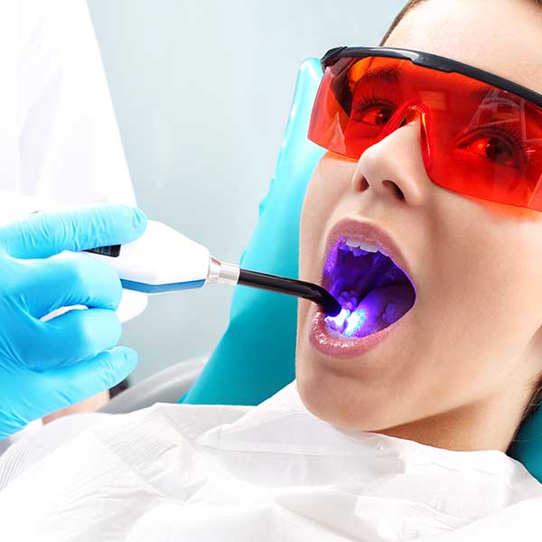 Dental Bonding | Montgomery Dental Centre | NW Calgary | Family and General Dentist