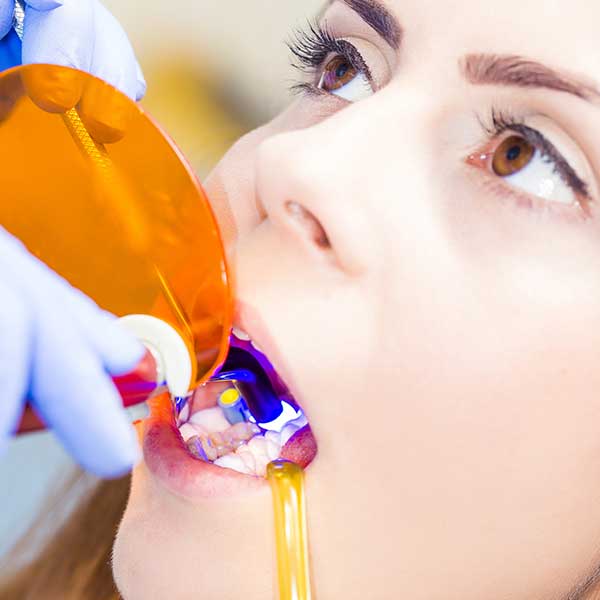 Dental Tooth Bonding | Montgomery Dental Centre | NW Calgary | Family and General Dentist